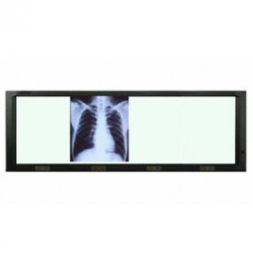 Negatoscopio cuadruple de pared con luz LED