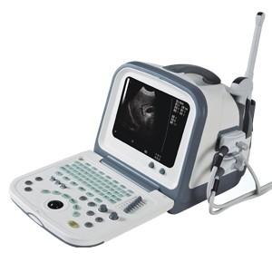 Equipo para ultrasonido digital haiying advanced portátil
