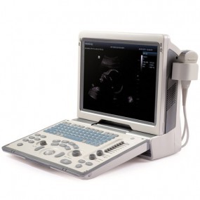 Ultrasonido portátil doppler color con transductor convexo