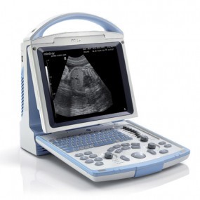 Ultrasonido portátil